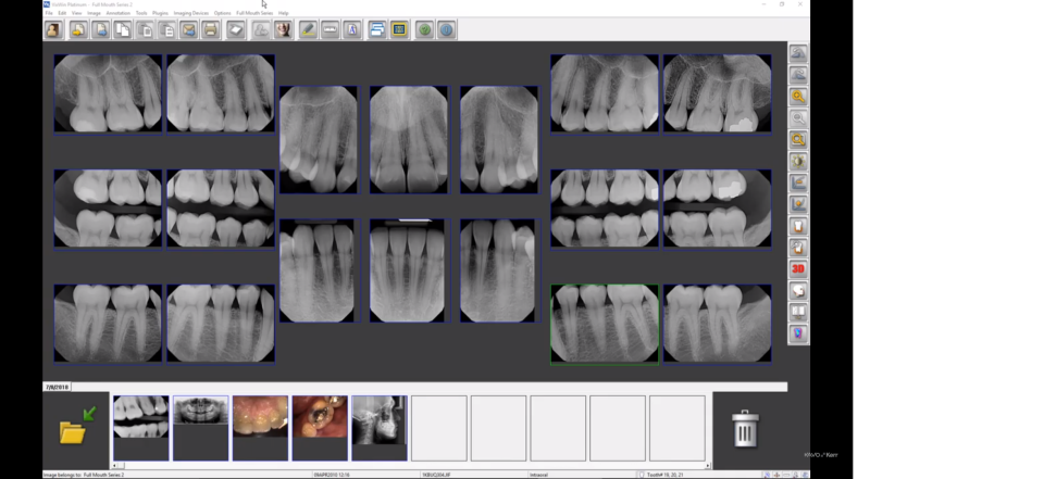 screenshot of Gendex VixWin Platinum